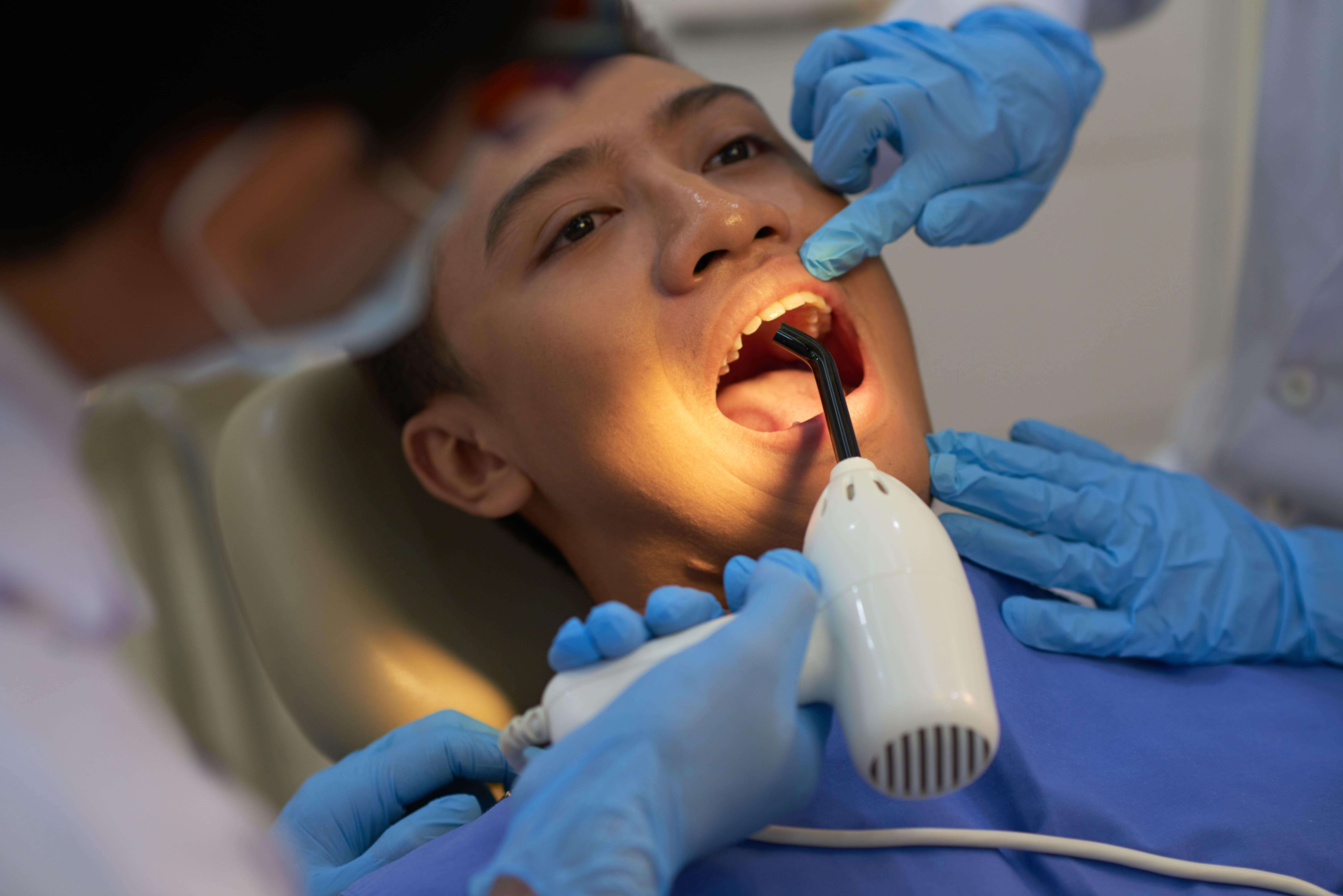 Professional full mouth scaling and polishing at DentoXpert in Thane