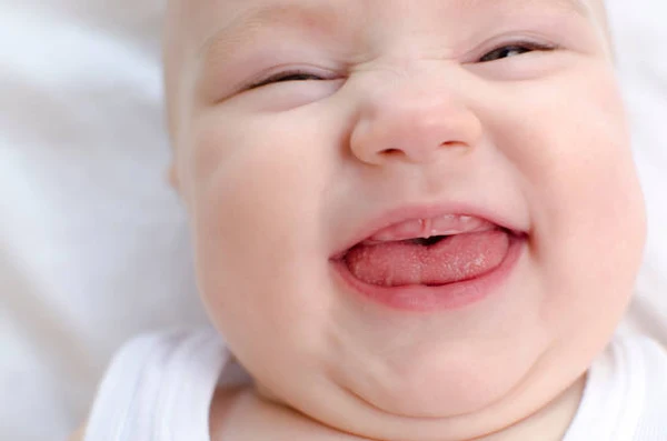Red and swollen gums during baby teething
